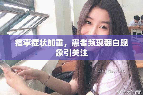 痉挛症状加重，患者频现翻白现象引关注