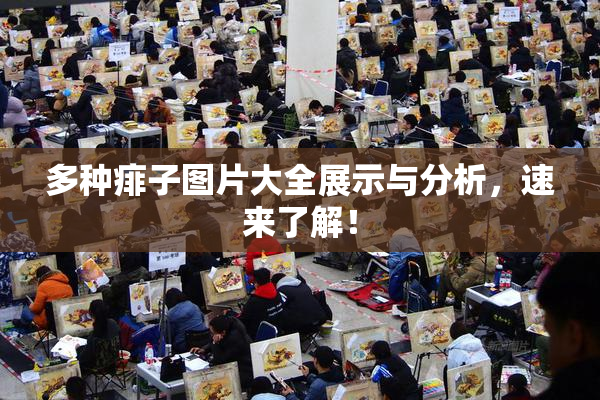 多种痱子图片大全展示与分析，速来了解！