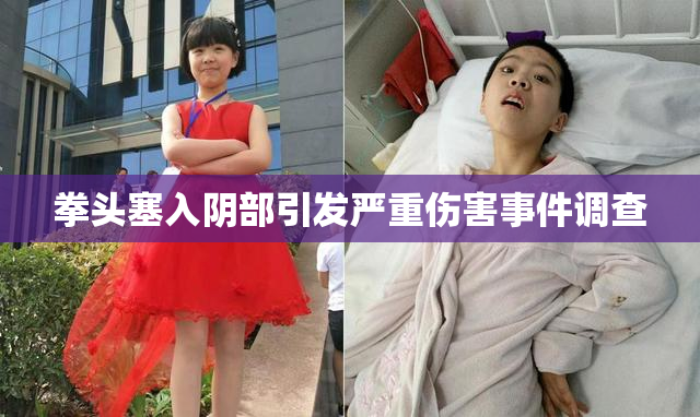 拳头塞入阴部引发严重伤害事件调查