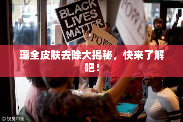 瑶全皮肤去除大揭秘，快来了解吧！