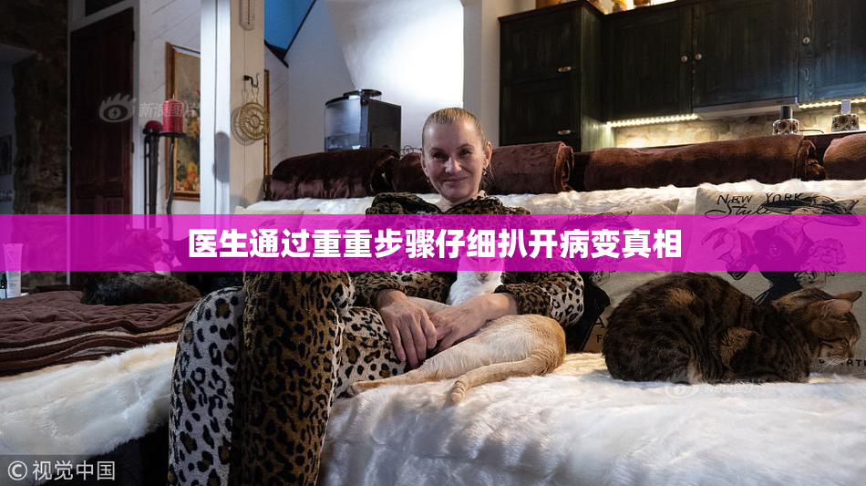 医生通过重重步骤仔细扒开病变真相