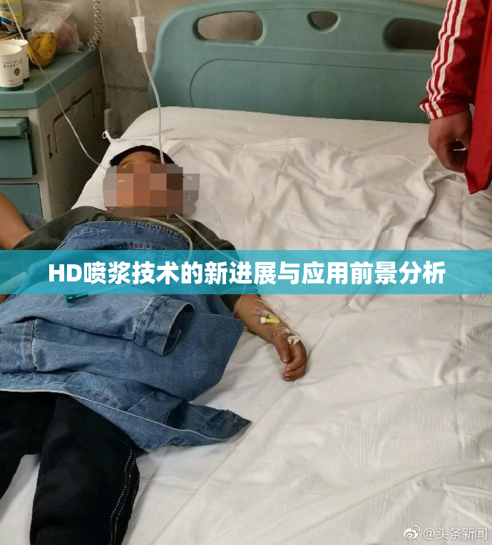 HD喷浆技术的新进展与应用前景分析