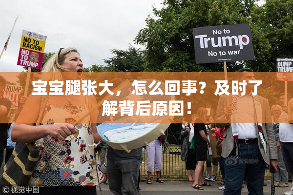 宝宝腿张大，怎么回事？及时了解背后原因！