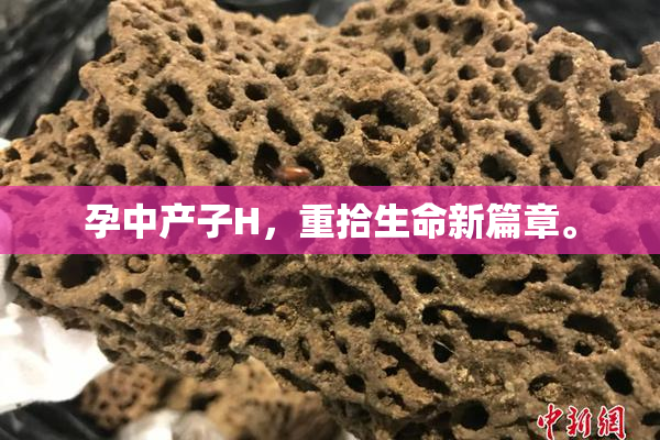 孕中产子H，重拾生命新篇章。